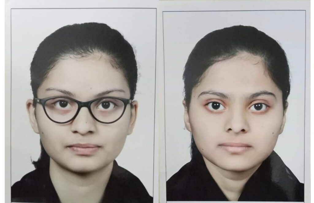 उदगीरच्या जुळ्या बहिनिंना शासकीय वैद्यकीय महाविद्यालयात प्रवेश