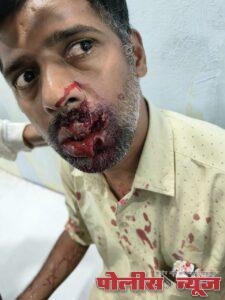 शहरातील भटके कुत्र्यावर निर्बंध घाला अन्यथा मुख्याधिकारी यांच्या दालनात कुत्रे सोडणार - प्रेम तोगरे