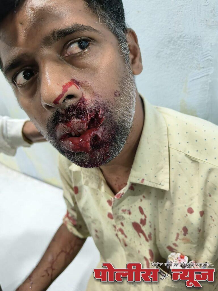 शहरातील भटके कुत्र्यावर निर्बंध घाला अन्यथा मुख्याधिकारी यांच्या दालनात कुत्रे सोडणार - प्रेम तोगरे